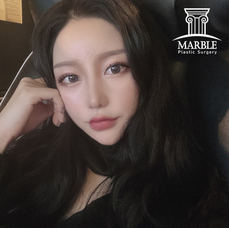 강남역성형외과, 쌍꺼풀후기 첫 눈에 반하는 눈! 관련 이미지 6