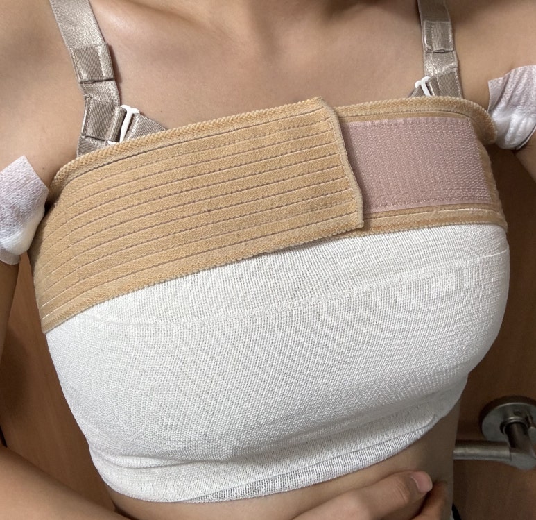Different Texture and Volume After Breast Surgery with Motiva image 5