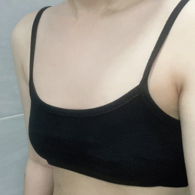 [Gangnam Plastic Surgery Breast Augmentation Real Review] I Was Tired of Not Wanting to Wear a Bra Top—My Uneven Breasts Are Finally Corrected, and I’m So Satisfied with the Upper Volume Lineㅎㅎ image 5