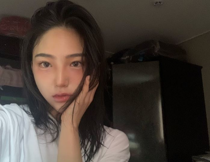 쌍꺼풀풀림 왜 풀리는지 해결 방법은 무엇일까? 관련 이미지 3