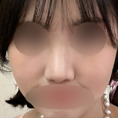 복코수술비용, 정확하게 찾아봐야 하는 이유 관련 이미지 7