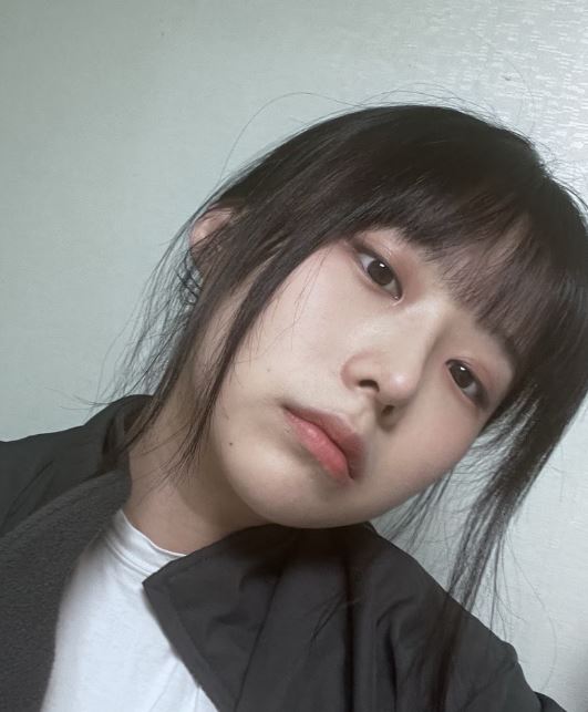 자연유착 쌍꺼풀 인기 많은 이유? 관련 이미지 4