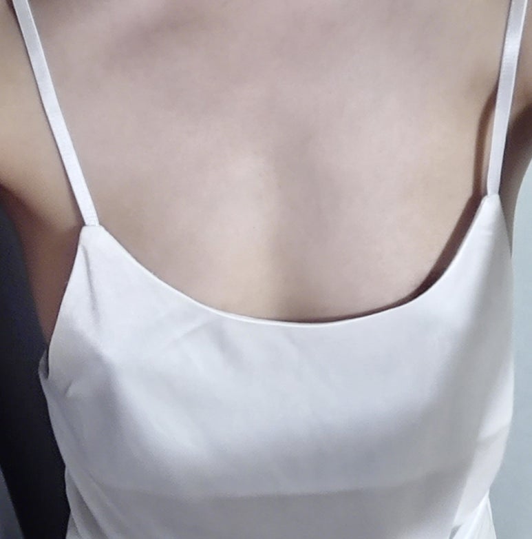 가슴확대술 비용, 종류별로 차이가 나는 이유 관련 이미지 3