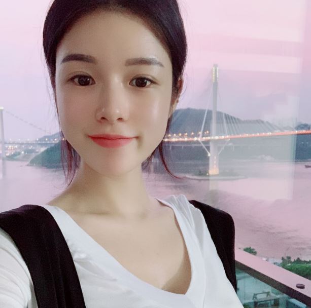 자연유착 쌍꺼풀 자연스럽게!! 관련 이미지 2