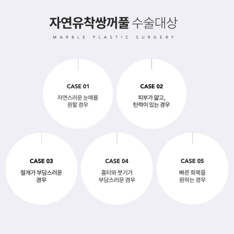 자연유착 흉터 붓기 최소화 지향한 내추럴한 쌍꺼풀 관련 이미지 5