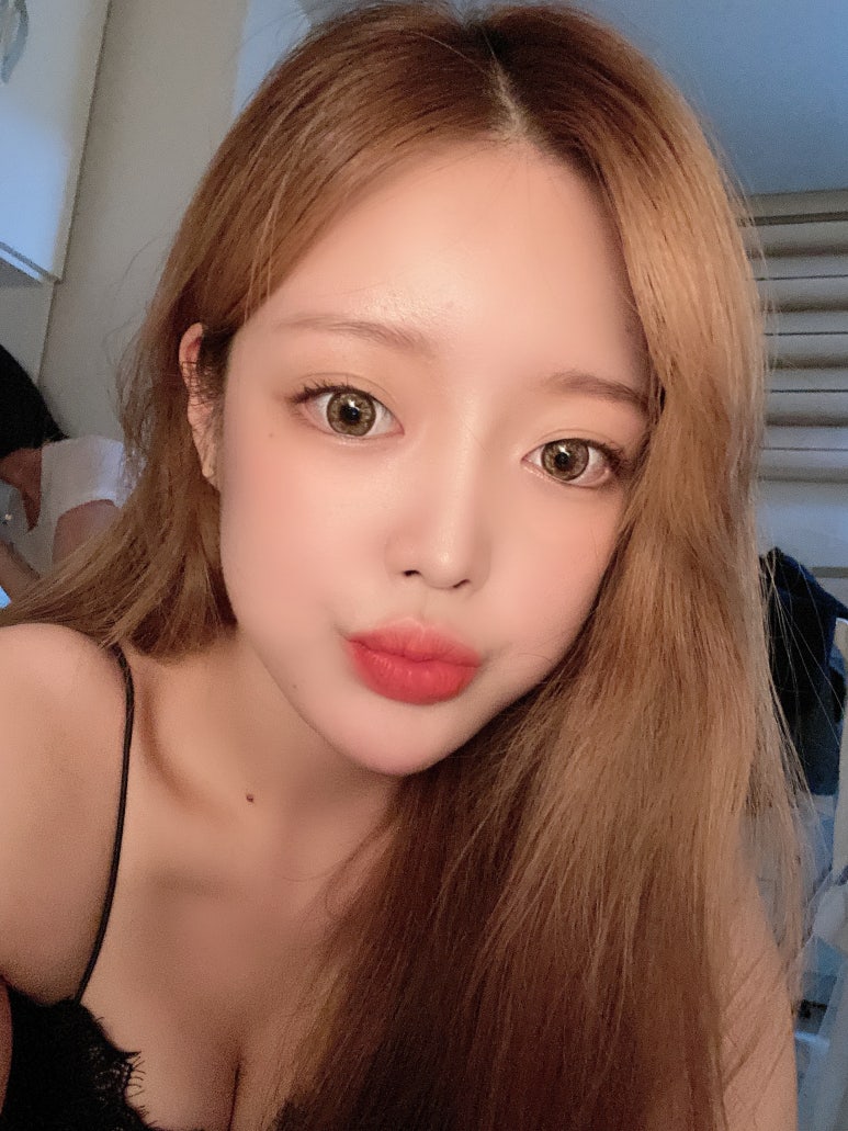 뒤트임비용 체크해야 할 점은? 관련 이미지 7