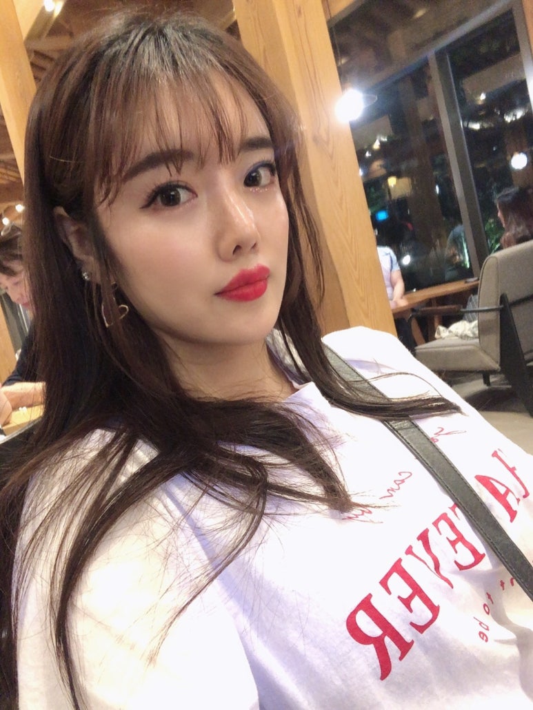 쌍꺼풀재수술 꼼꼼하고 신중하게 결정 관련 이미지 5