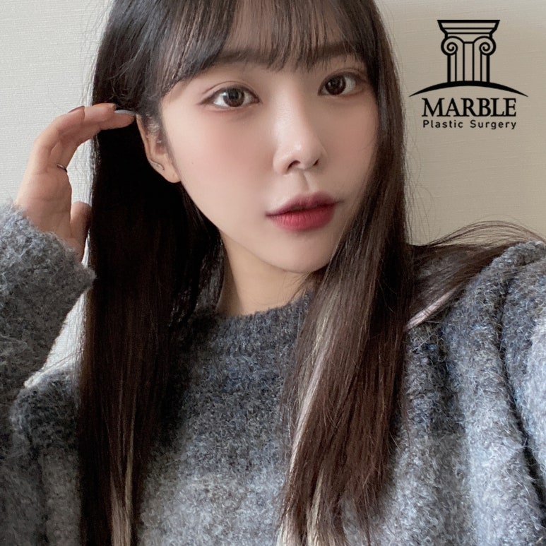 강남성형외과 나에게 맞는 눈성형을 해야 하는 이유 관련 이미지 1
