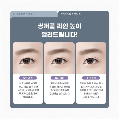 고등학생성형이벤트, 안전하고 현명하게 선택하는 법 관련 이미지 6