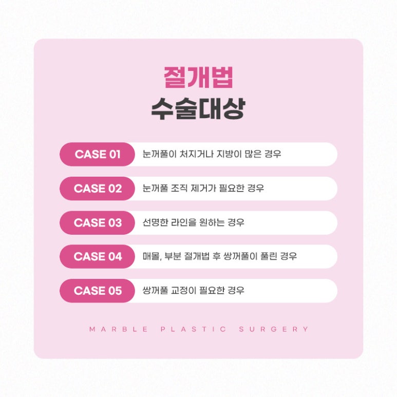 쌍수절개법 자연스러움을 더하다! 마블성형외과 관련 이미지 4