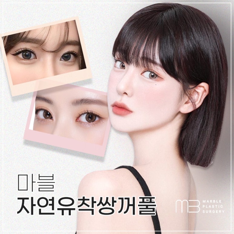 고등학생성형이벤트, 안전하고 현명하게 선택하는 법 관련 이미지 1