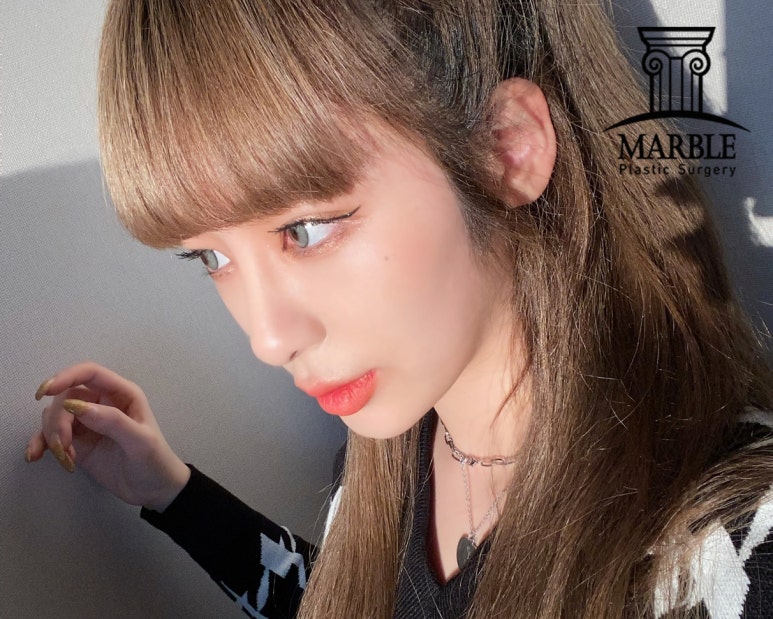 듀얼트임, 자연스럽게 예뻐지는 방법! 마블성형외과의원 관련 이미지 5