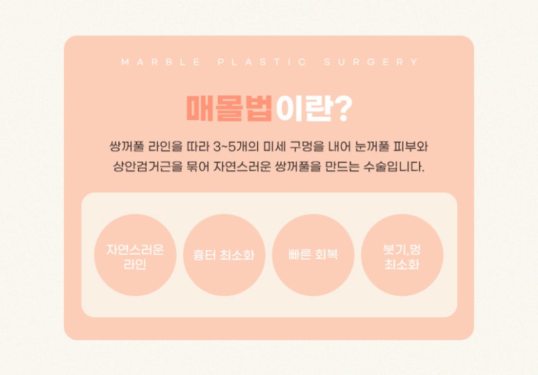 쌍수매몰 알아야 할 사실들 마블성형외과의원 관련 이미지 2