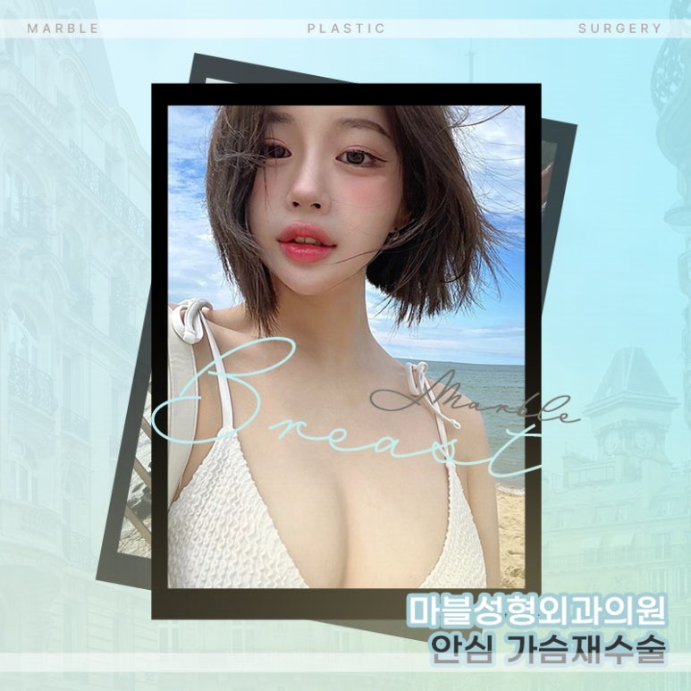 가슴성형재수술 언제 받아야 할까? 실패 원인부터 시기까지｜마블성형외과 관련 이미지 6
