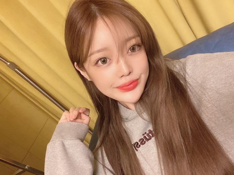 눈뒤트임이 고민이라면? 마블성형외과의원 관련 이미지 1