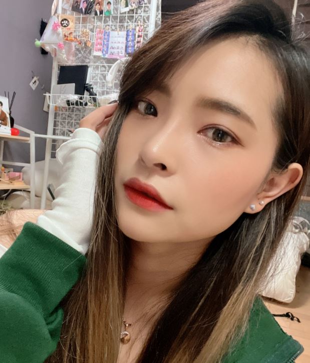 쌍수잘하는곳 수술 전 입문 포인트! 관련 이미지 7