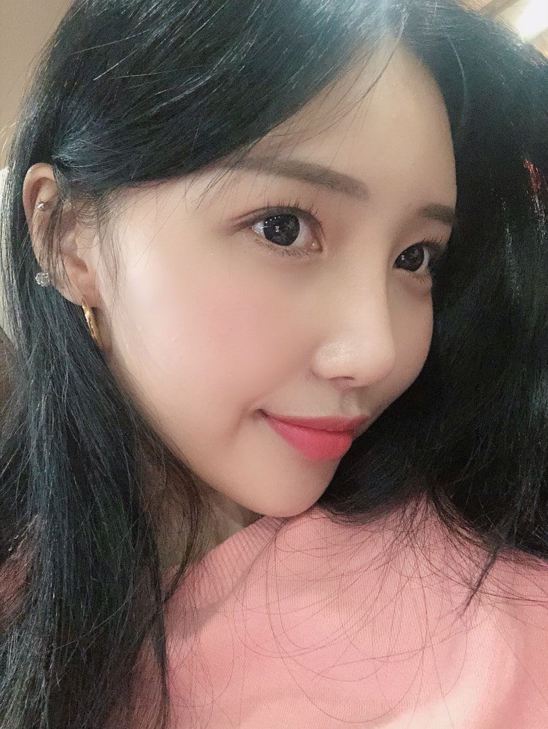 강남쌍꺼풀수술 체크해야 할 사항은? 관련 이미지 2