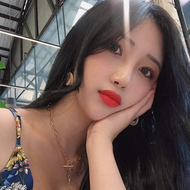 눈밑지방재배치 언제가 좋을까? 관련 이미지 2
