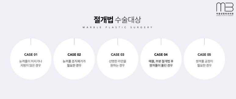 첫쌍수 리얼상세후기 마블 관련 이미지 13