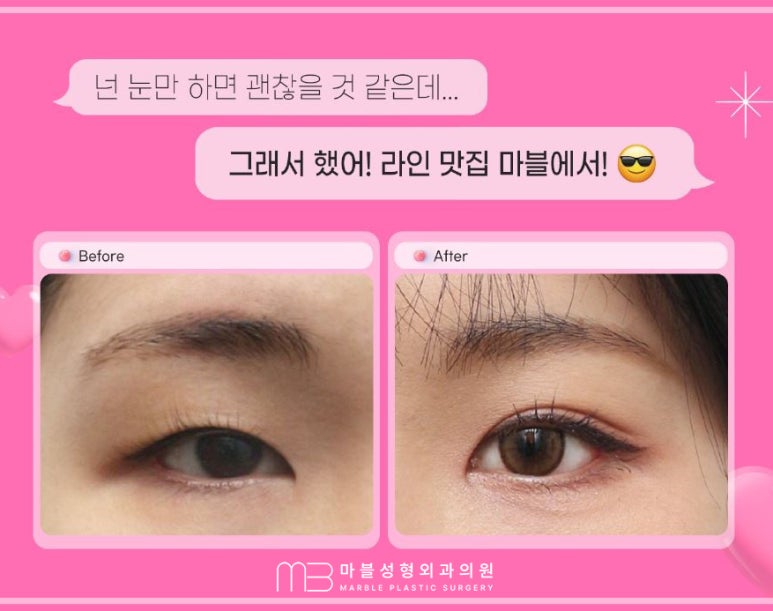 첫쌍수 리얼상세후기 마블 관련 이미지 3