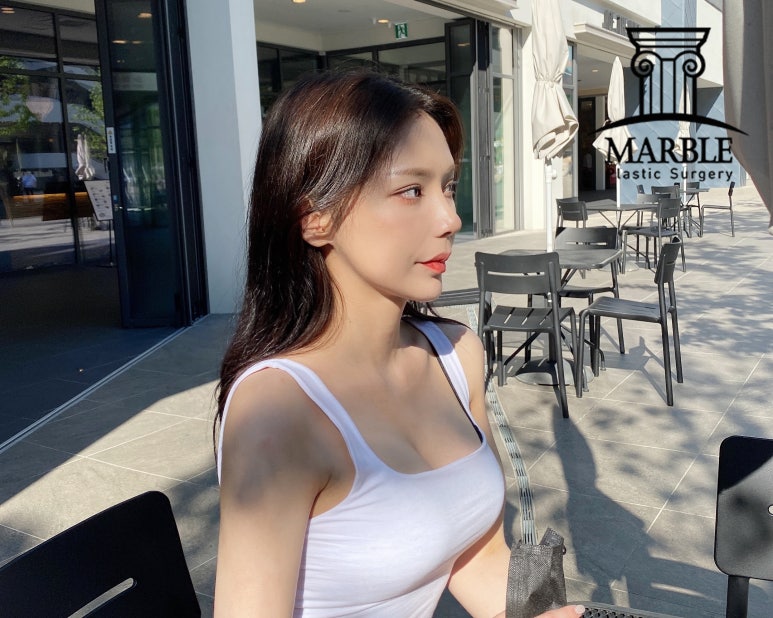 눈밑지방재배치, 뚜렷한 인상을 주기 위해 마블성형외과의원 관련 이미지 1