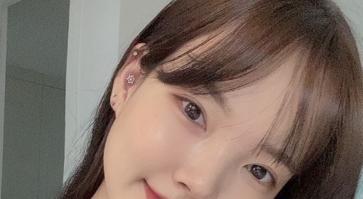 쌍수 붓기시간 수술법에 따라 다르다? 관련 이미지 2