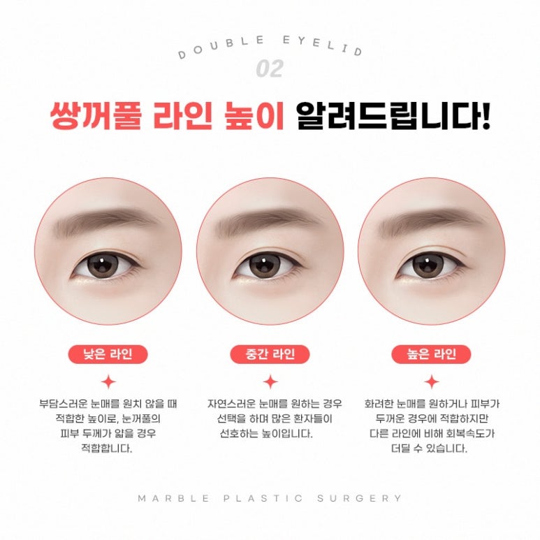 눈성형으로 얼굴비율 맞추기! 디자인의 중요성 관련 이미지 4