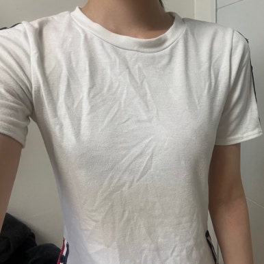 [Gangnam Plastic Surgery Breast Surgery Review] Worried About Uneven Breasts.. After Meeting Director Seo Il-beom, with 25 Years of Experience, I Found the Perfect Volume! image 3