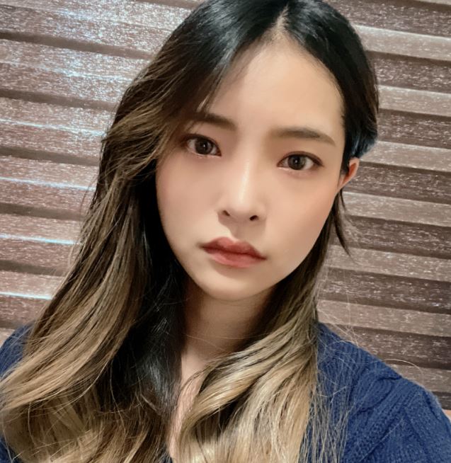 쌍수잘하는곳 수술 전 입문 포인트! 관련 이미지 8