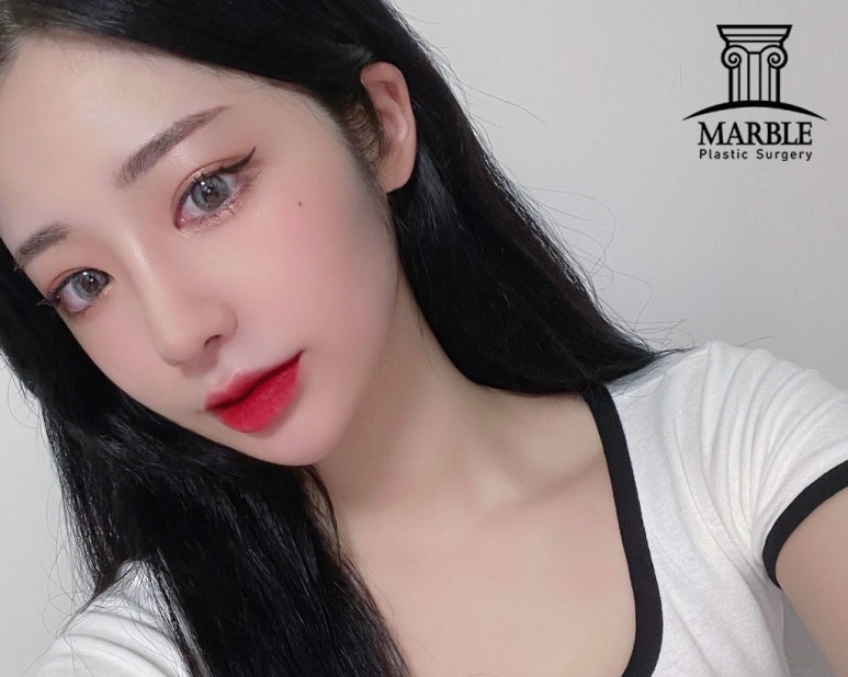듀얼트임, 자연스럽게 예뻐지는 방법! 마블성형외과의원 관련 이미지 7