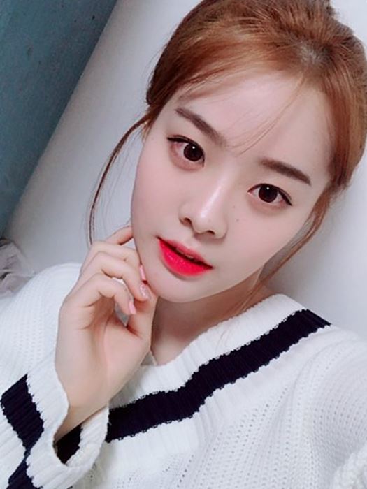 이중턱없애기 아큐스컬프로 효과 있을까? 마블성형외과의원 관련 이미지 9