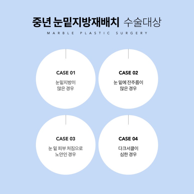 중년눈성형 작은 변화가 만든 아름다운 동안 눈매 관련 이미지 4