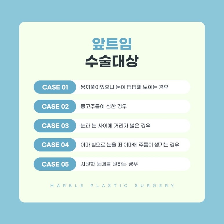 트임수술은 마블성형외과의원 관련 이미지 3