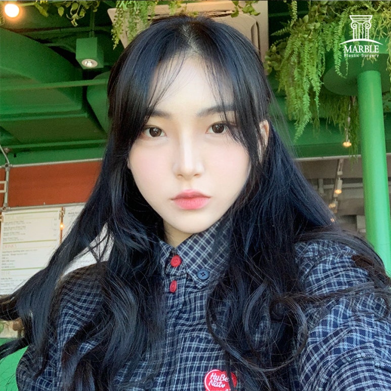 쌍꺼풀매몰후기 찾아보고 있다면 관련 이미지 2