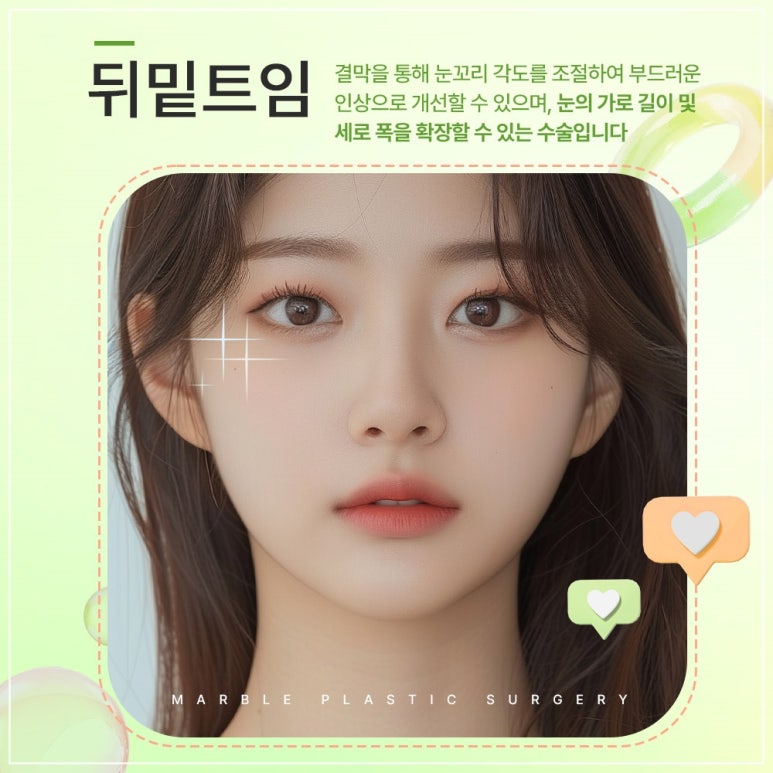 고등학생트임성형 마블 수험생이벤트 ✔ ✔ 관련 이미지 1