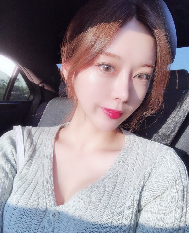 눈매교정수술 혹시 안검하수일까요?마블성형외과의원 관련 이미지 4