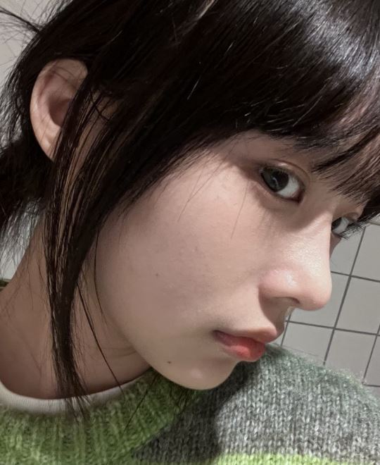자연유착 쌍꺼풀 인기 많은 이유? 관련 이미지 3