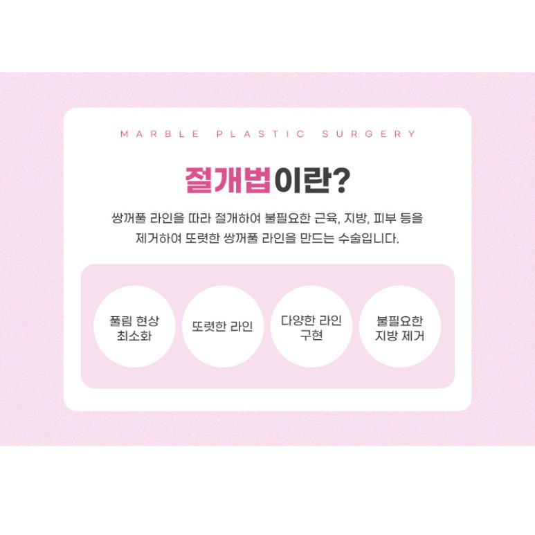 쌍수절개법 자연스러움을 더하다! 마블성형외과 관련 이미지 2