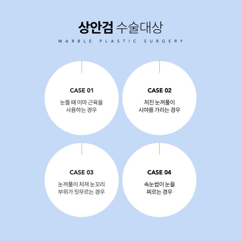 중년눈성형 잘 알아보고 해야 하는 이유? 관련 이미지 3