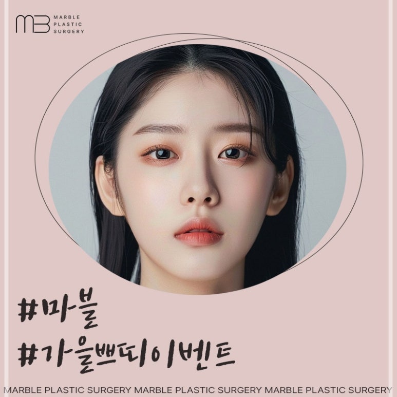 V업주사 마블성형외과 윤곽주사 이벤트기간 공유! 관련 이미지 4