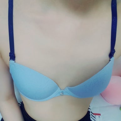 [Marvel Plastic Surgery Breast Augmentation Review] I had surgery because my breasts were completely flat, and I’m so satisfied that I feel like I should have done it sooner! image 3