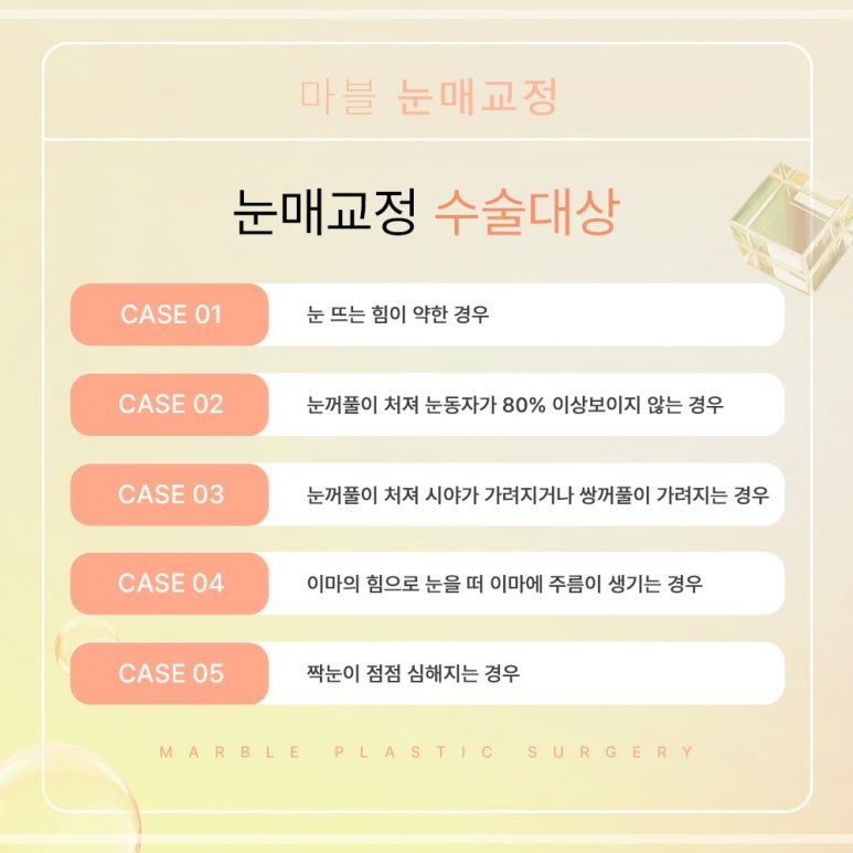 비절개눈매교정잘하는곳 장점, 선택 시 고려사항, 비용 관련 이미지 8