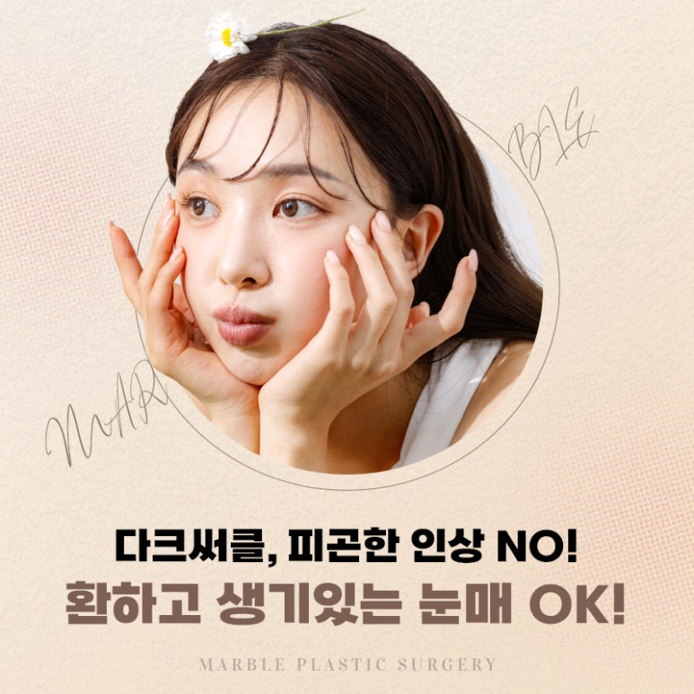 눈밑지방재배치 다크서클에 도움될 수 있을까 관련 이미지 5