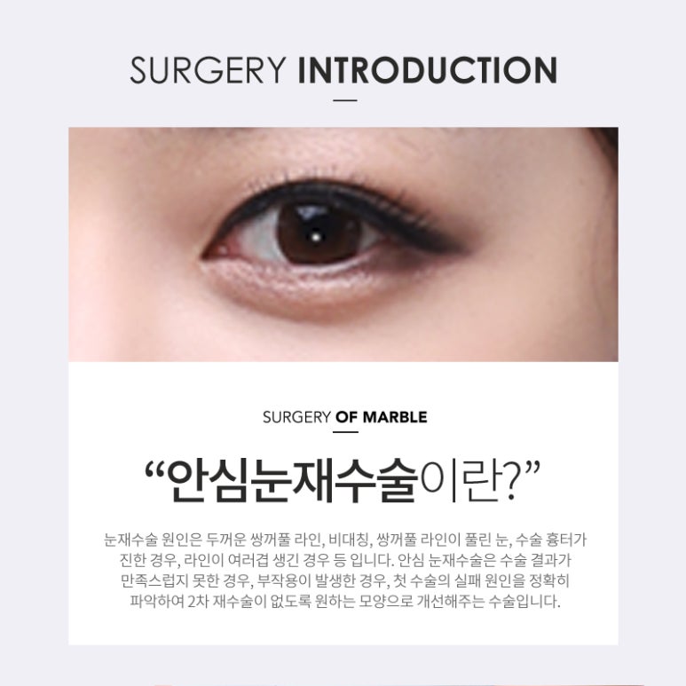 쌍꺼풀재수술 알아보고 반복하지말자 관련 이미지 3