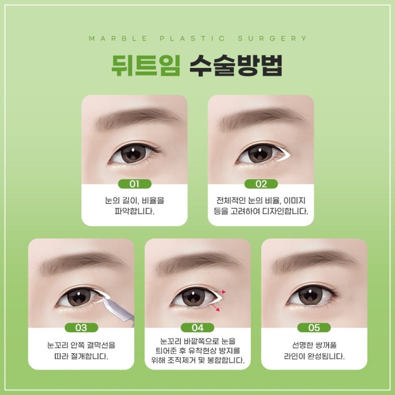 고등학생트임성형 마블 수험생이벤트 ✔ ✔ 관련 이미지 5