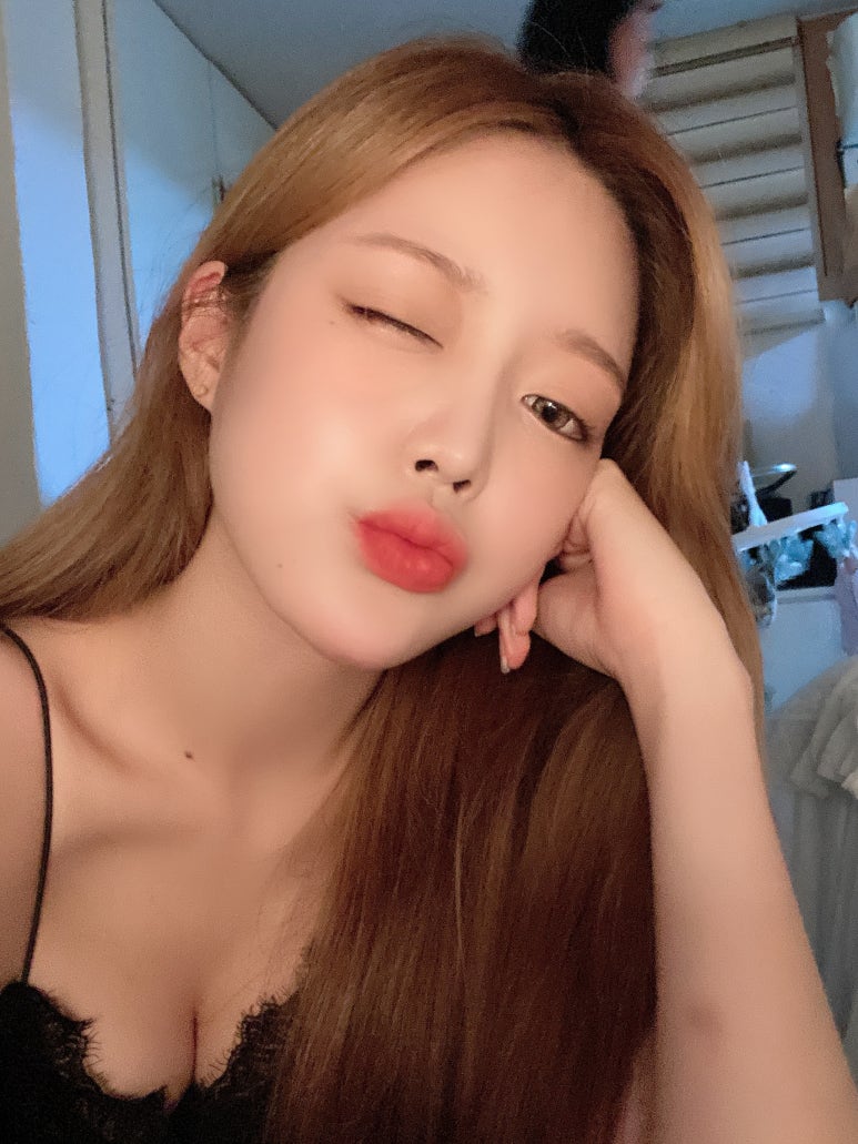 눈밑지방재배치 알아가는 정보! 마블성형외과의원 관련 이미지 4