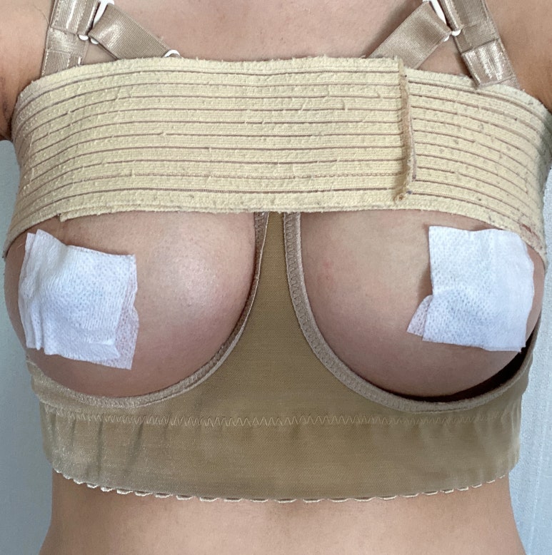 가슴확대수술 첫 수술, 어떤 기준으로 결정해야 할까요? 관련 이미지 5