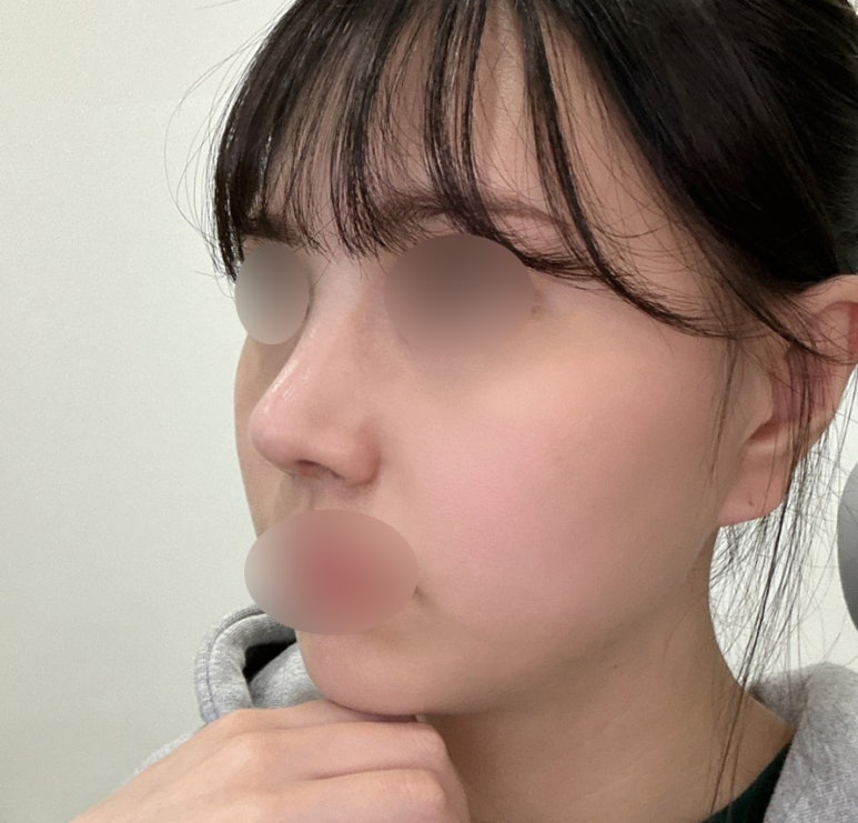 복코수술비용, 정확하게 찾아봐야 하는 이유 관련 이미지 5