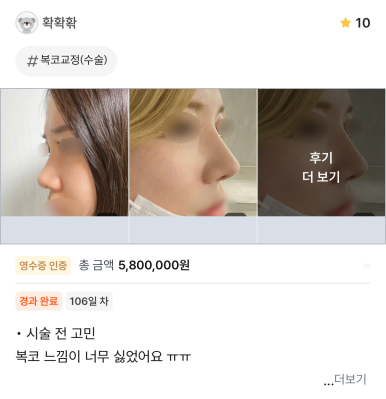 [Gangnam Plastic Surgery Revision Rhinoplasty Review] My bulbous nose showed no improvement at all… I found the nose shape I’ve always wanted after meeting Dr. Junhyung Kim haha image 1