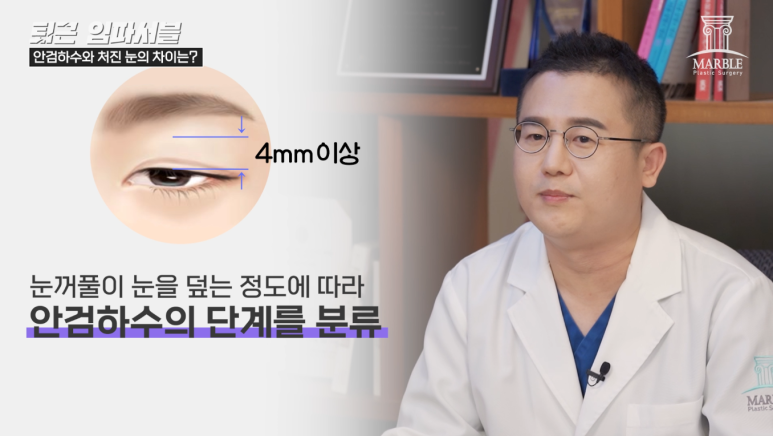 눈매교정수술 눈처짐 개선할 수 있을까? 관련 이미지 7